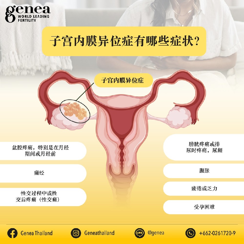 Endometriosis-01-CN.jpg